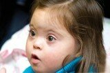 sindrome-down